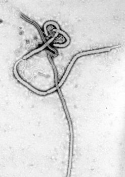 424px-Ebola_virus_em.jpg